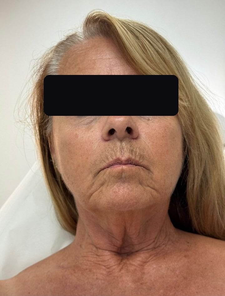 Client before treatment